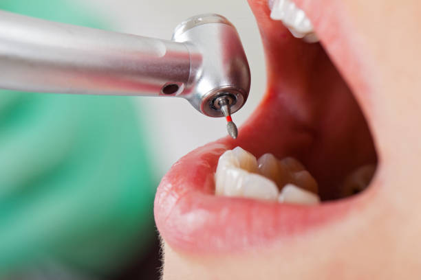 Best Dentist Open Late Near Me  in Pevely, MO